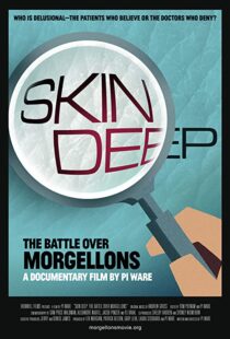 دانلود مستند Skin Deep: The Battle Over Morgellons 2019104233-356057571